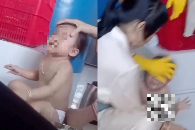 Cháu bé bị bảo mẫu ấn ngửa cổ,
