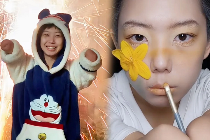 Dù bị khuyết tật từ nhỏ, Xu vẫn theo đuổi đam mê làm đẹp.