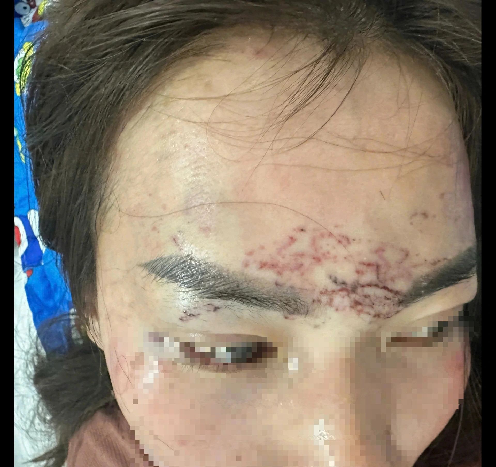 Một phụ nữ ở Cà Mau tố bị nhóm người đánh đập, cắt tóc… vì ghen - Ảnh 1.