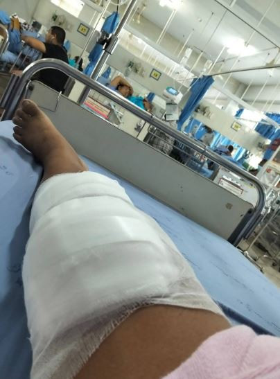 Bị rắn hổ mang cắn, người phụ nữ 47 tuổi tay không hạ gục con rắn rồi mang đến bệnh viện- Ảnh 2.