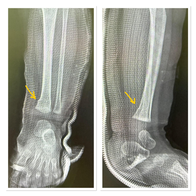 Cả gia đình đi ô tô gặp nạn rồi tử vong, nhìn thành viên duy nhất còn sống sót khiến ai cũng ái ngại- Ảnh 3.