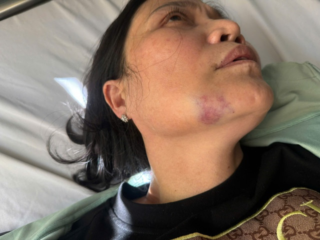 Khởi tố 2 anh em đánh nữ y sĩ tới tấp- Ảnh 1.