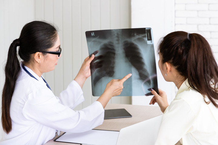 28 tuổi bị ung thư phổi và lời cảnh báo từ bác sĩ khiến nhiều người giật mình - 3