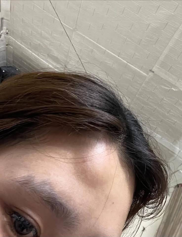 Tình hình sức khoẻ hiện tại của nữ sinh bị đánh nhập viện vì mâu thuẫn