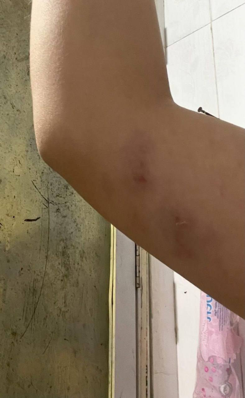 Tình hình sức khoẻ hiện tại của nữ sinh bị đánh nhập viện vì mâu thuẫn