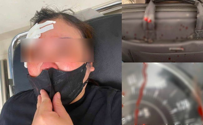 Dừng xe nghe điện thoại, người phụ nữ bị đánh giữa phố Hà Nội bằng gậy sắt: Nguyên nhân được tiết lộ- Ảnh 1.