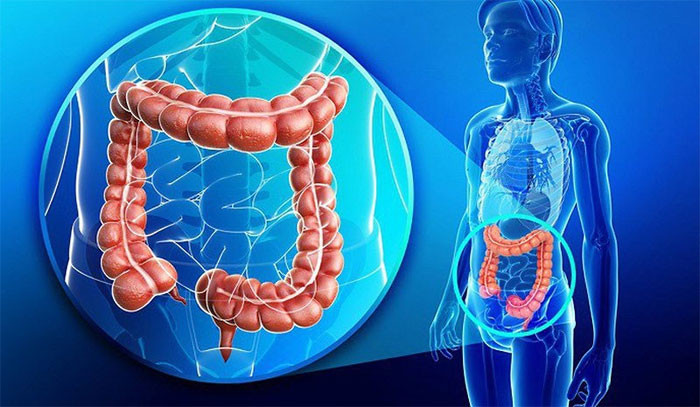 Bác sĩ cảnh báo Dấu hiệu sớm của ung thư trực tràng không phải là đại tiện ra máu mà là 5 bất thường sau trên cơ thể tuyệt đối đừng bỏ qua