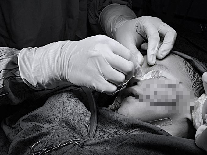 Bé 2 tuổi bị chó nhà nuôi tấn công- Ảnh 1.