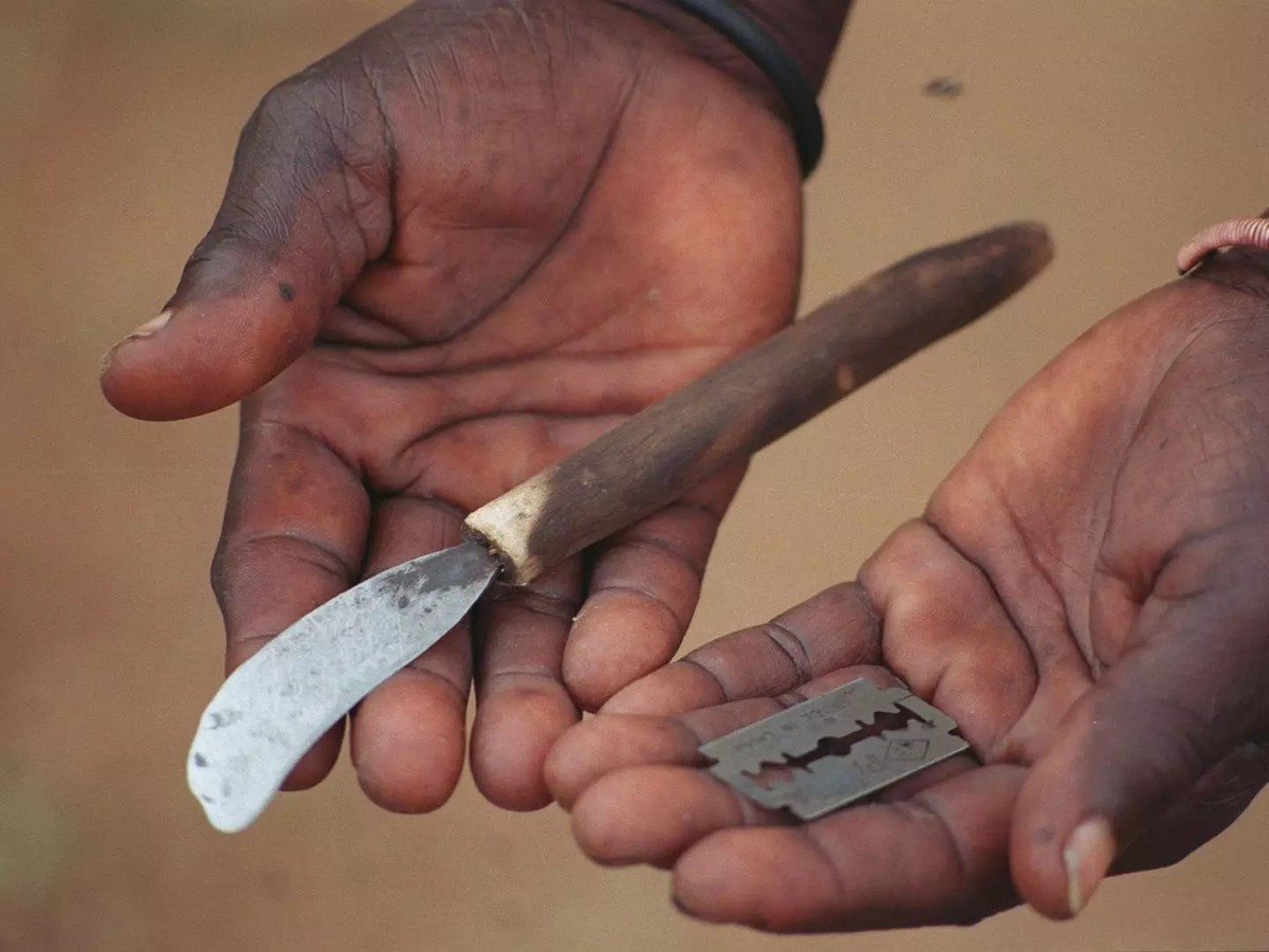 Rợn người hủ tục cắt bộ phận sinh dục của bé gái ảnh 3