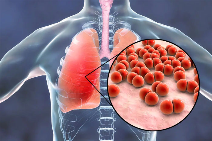 Phổi có khỏe hay không nhìn tay là biết Người bệnh phổi có 5 dấu hiệu bất thường ở bàn tay hãy tự kiểm tra