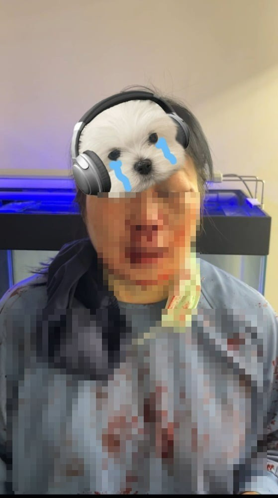 Phẫn nộ nam thanh niên 21 tuổi hành hung nữ nha sĩ suýt mù mắt- Ảnh 2.