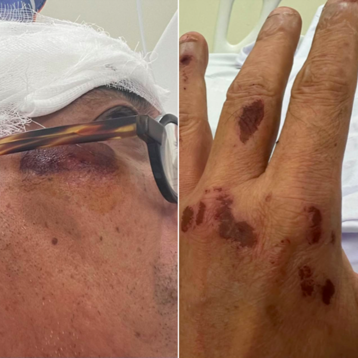 Nhà thơ Nguyễn Quang Thiều bị tai nạn giao thông vào chiều 21/5.