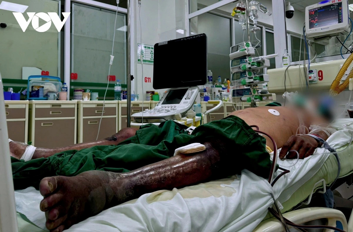 nguoi dan ong hoai tu toan bo chan trai vi ly do tuong chung nho nhat hinh anh 1