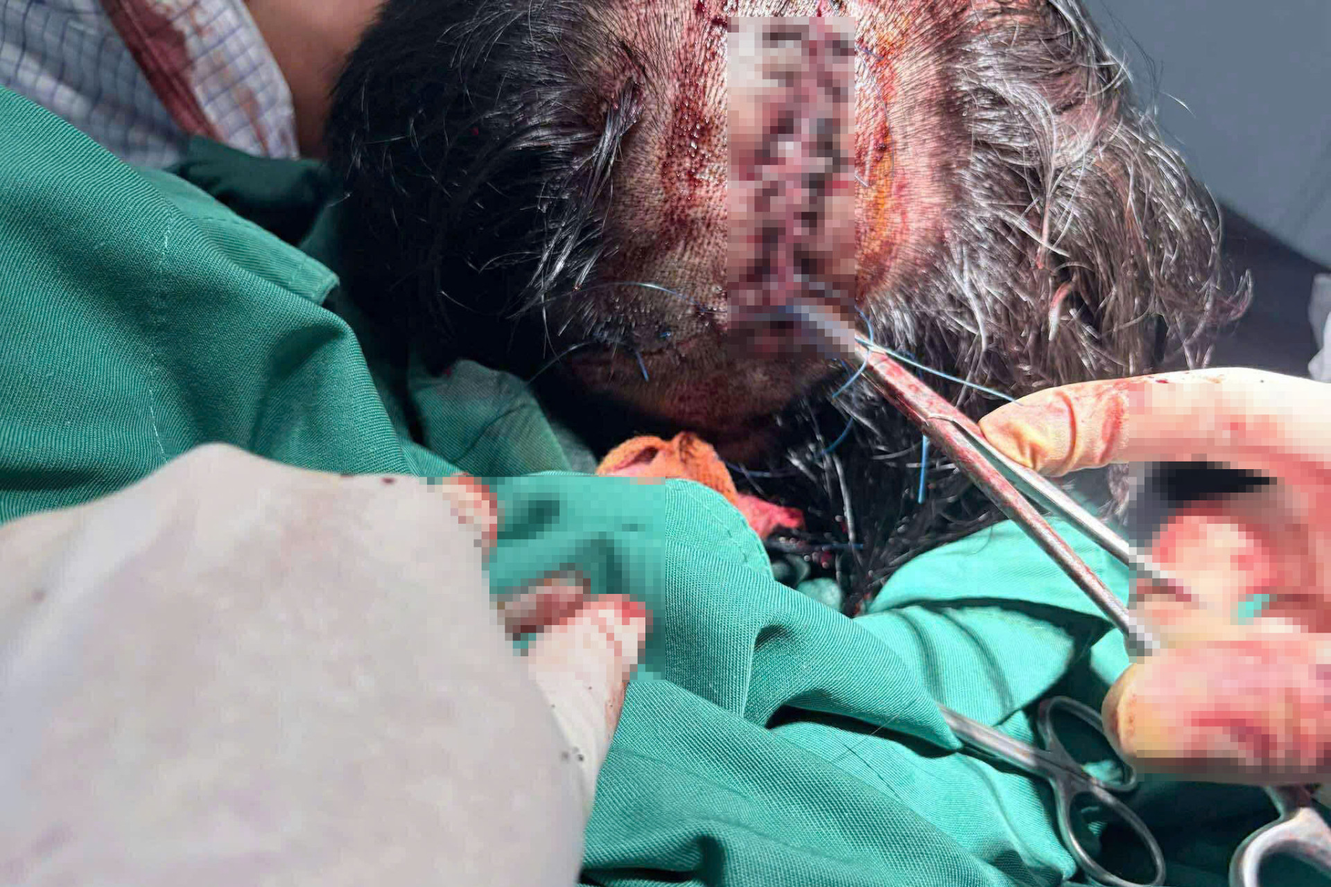 dam dong nghiep (1).jpg