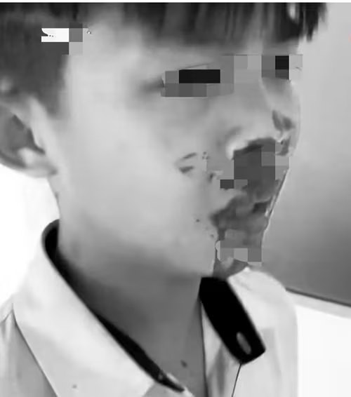 Làm rõ nghi vấn phụ huynh đánh nam sinh lớp 7 nhập viện- Ảnh 1.