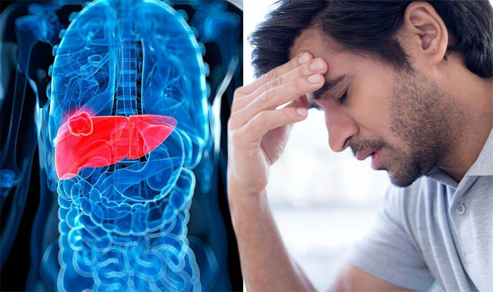Gan cứng lại đầu báo trước Nếu người già xuất hiện 4 dấu hiệu này ở đầu nên đi khám sớm