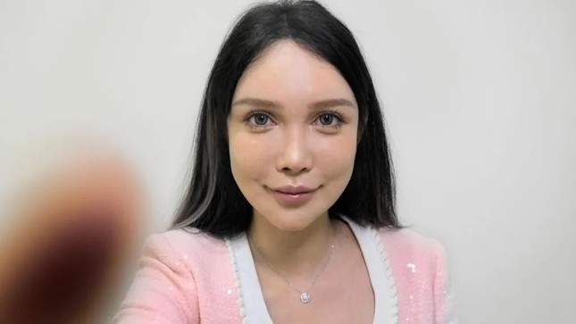 Bên trong cơn sốt phẫu thuật thẩm mỹ ở Trung Quốc ảnh 2