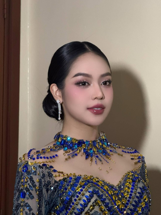 Hoa hậu Thanh Thủy nhập viện ở Indonesia- Ảnh 1.