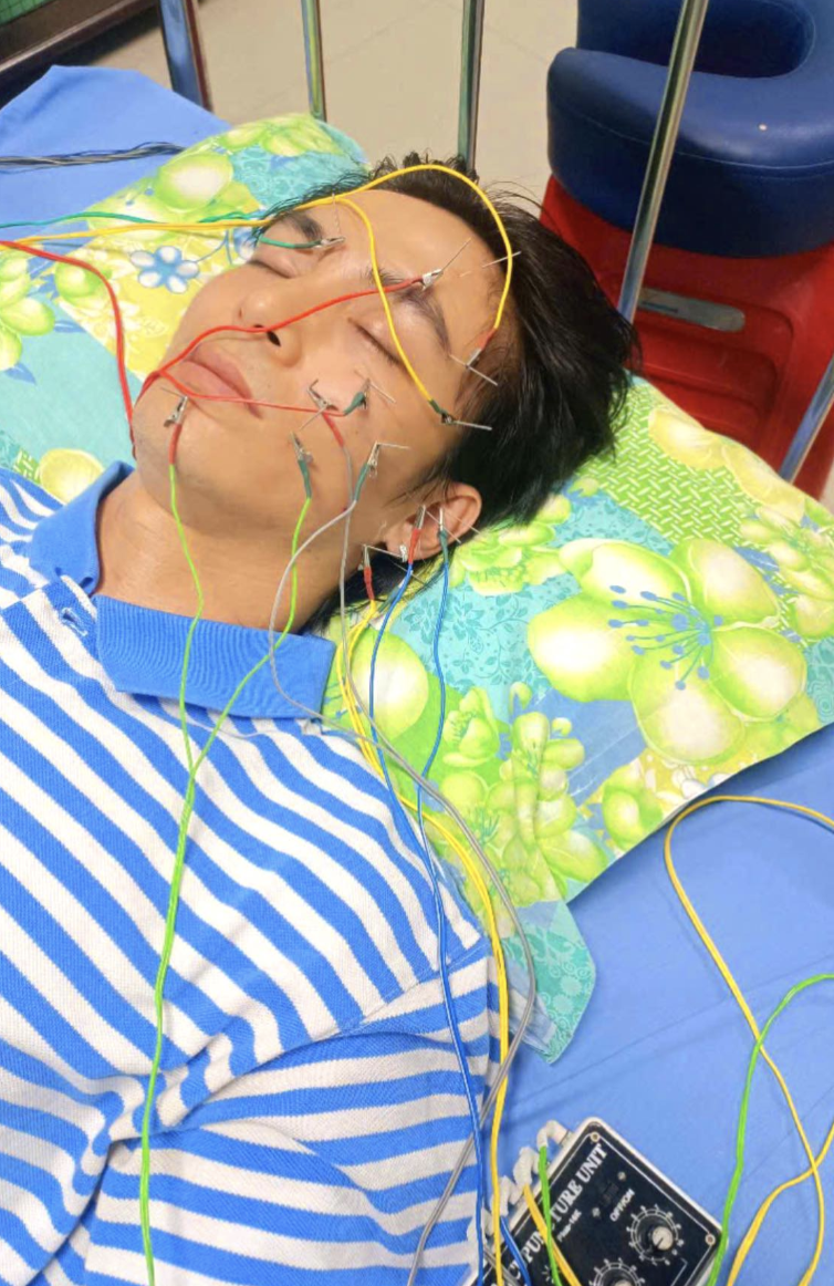 Diễn viên Lãnh Thanh bị liệt dây thần kinh số 7   - Ảnh 1.