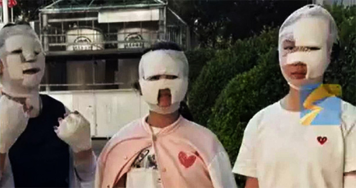 Hình ảnh được anh Trần chia sẻ cho thấy những người bị bỏng do bếp gas bị quấn băng quanh mặt như xác ướp.