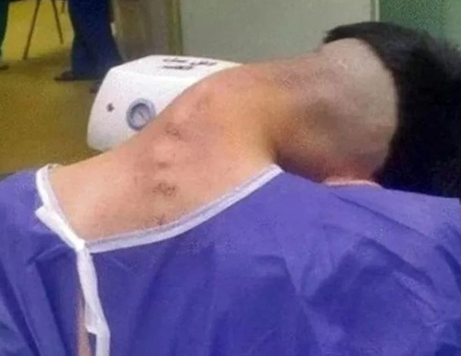 Thường xuyên làm việc này, chàng trai 23 tuổi mắc