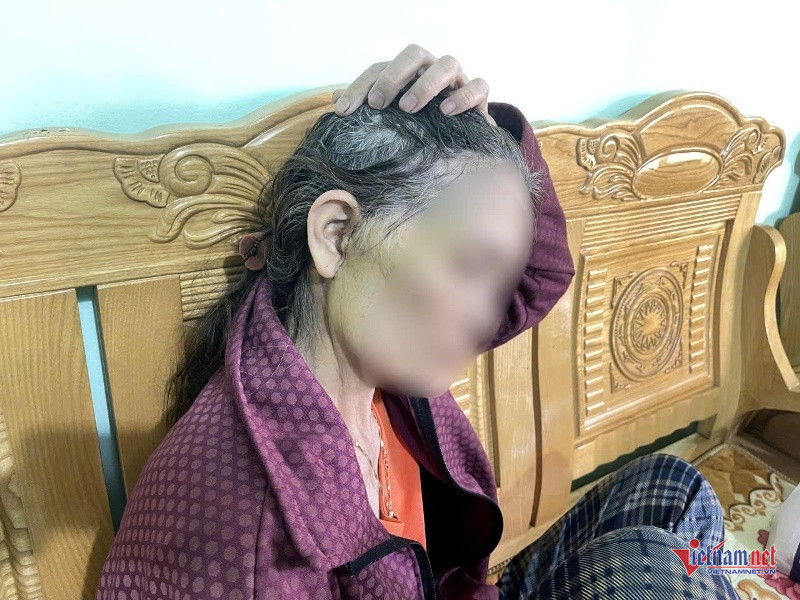 W-Biến chứng sau phẫu thuật thẩm mỹ.jpg