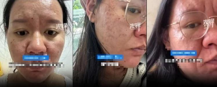 Người phụ nữ gây sốc vì gương mặt như bà lão khi mang thai- Ảnh 1.