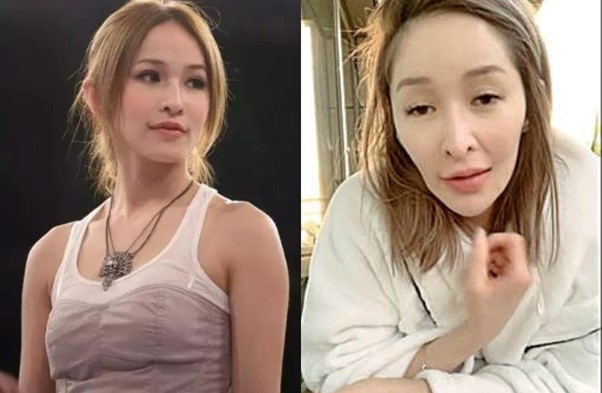 Sốc nặng trước diện mạo biến dạng của nữ diva nổi tiếng sau vụ bị chó cắn đến hủy dung- Ảnh 3.