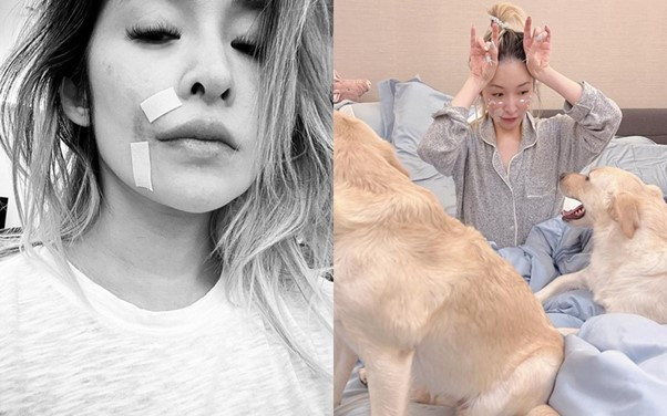 Sốc nặng trước diện mạo biến dạng của nữ diva nổi tiếng sau vụ bị chó cắn đến hủy dung- Ảnh 4.