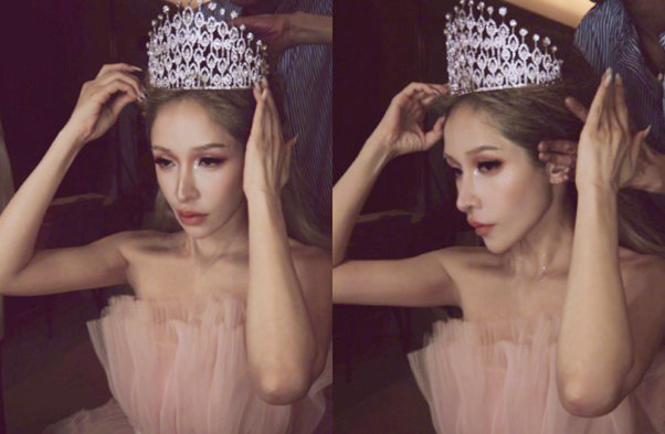 Sốc nặng trước diện mạo biến dạng của nữ diva nổi tiếng sau vụ bị chó cắn đến hủy dung- Ảnh 2.