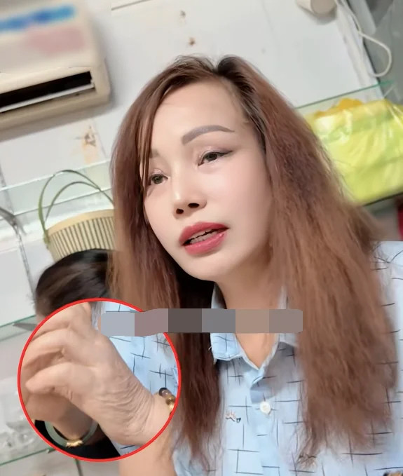 Cô dâu Cao Bằng lại dao kéo lần thứ n diện mạo mới nhiều người ngã ngửa