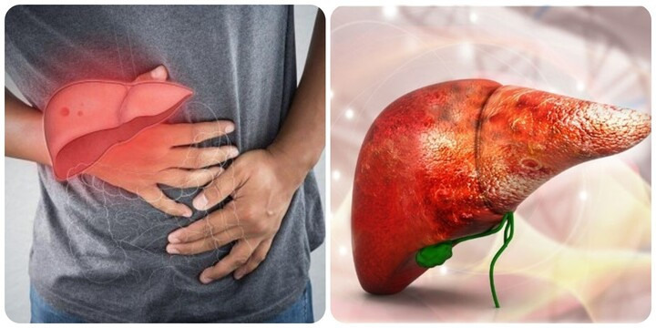 Ung thư gan là một trong những căn bệnh ung thư nguy hiểm.