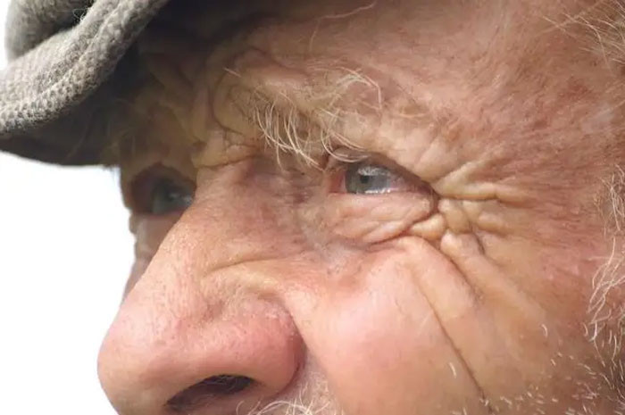 Đôi mắt là cơ quan đầu tiên dự đoán bệnh tật 5 thay đổi ở mắt báo hiệu nguy cơ mắc bệnh