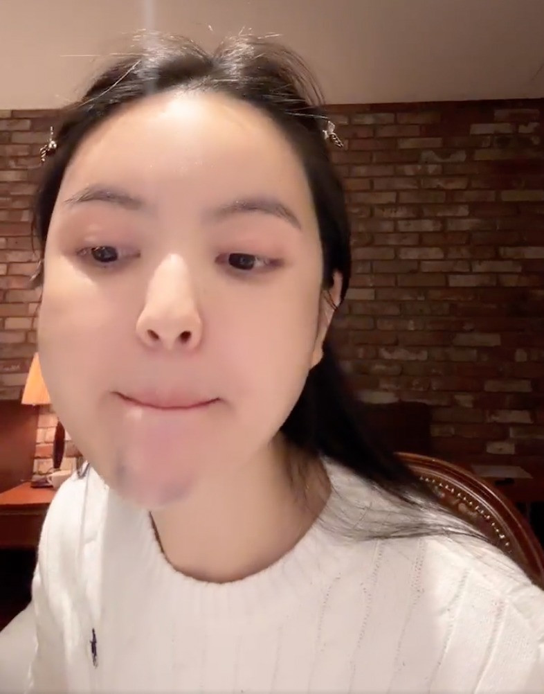 Trước khi tiết lộ bị biến chứng thẩm mỹ giật mình diện mạo vợ Quang Hải qua cam thường