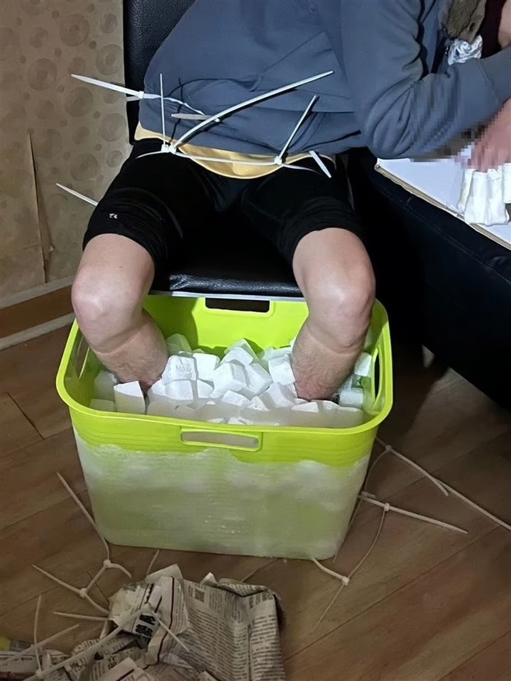 Trương ngâm chân trong đá khô tổng cộng 10 giờ. (Ảnh: Yahoo)