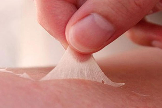 Dầu gội đầu bắt lửa, cô gái bị bỏng nửa người và mất 7 ngón tay插图3