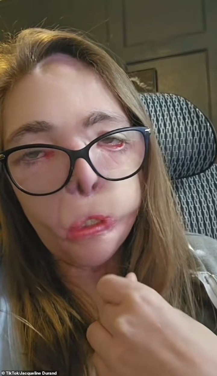 Jacqueline đã trải qua 28 ca phẫu thuật.