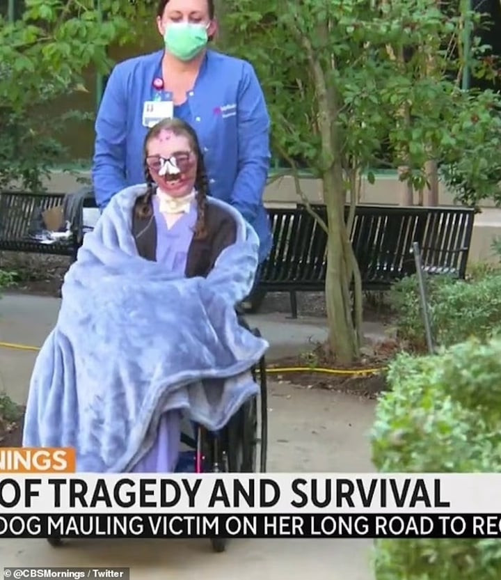 Jacqueline Durand hứng chịu hơn 800 vết cắn.