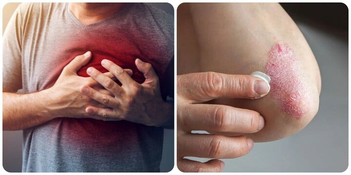 Khó thở và da khô là một trong những biểu hiện thận yếu