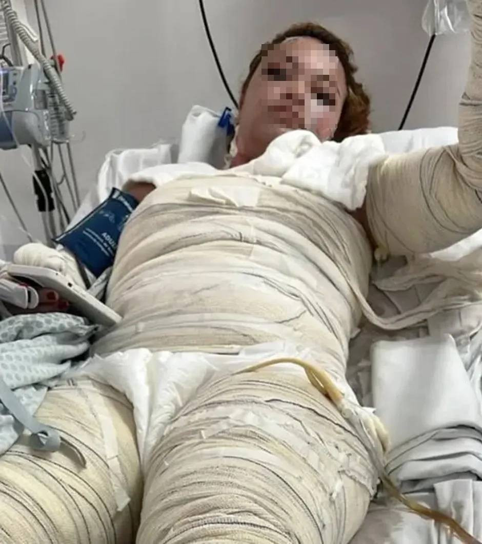 Người phụ nữ bỏng nặng, tử vong sau khi tắm nước nóng trong nhà nghỉ- Ảnh 1.