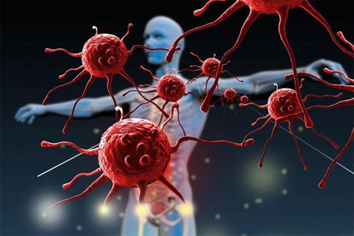 Nghiên cứu phát hiện Người ít có nguy cơ mắc khối u ác tính thường có 5 thói quen này bạn có không