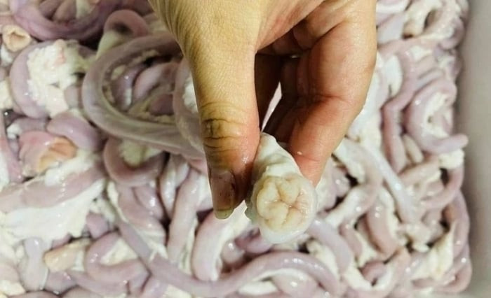 Nhiều người nguy kịch vì nhiễm liên cầu khuẩn lợn. (Ảnh minh họa)