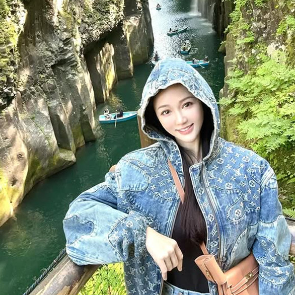 Tranh cãi chuyện nữ diễn viên nổi tiếng găm cả trăm cây kim lên mặt để 'trẻ mãi không già'- Ảnh 7.