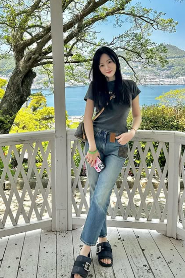 Tranh cãi chuyện nữ diễn viên nổi tiếng găm cả trăm cây kim lên mặt để 'trẻ mãi không già'- Ảnh 6.