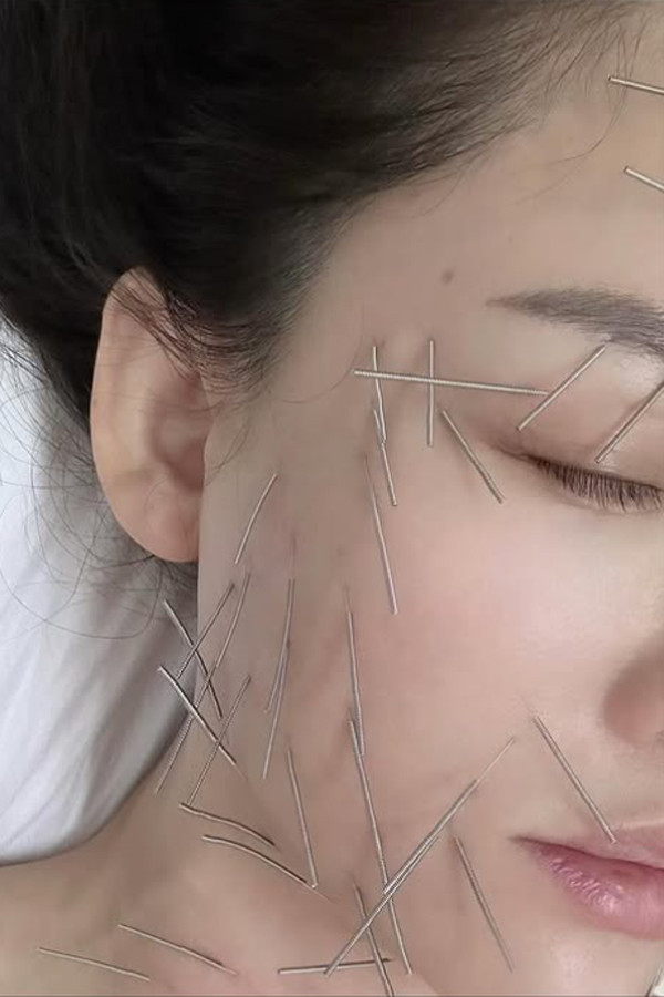 Tranh cãi chuyện nữ diễn viên nổi tiếng găm cả trăm cây kim lên mặt để 'trẻ mãi không già'- Ảnh 2.