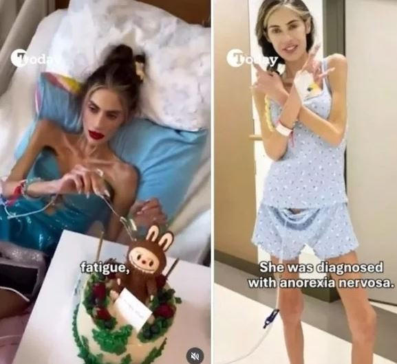 Giảm 40 kg trong 2 năm, cô gái 30 tuổi qua đời khi chỉ còn 22 kg- Ảnh 2.