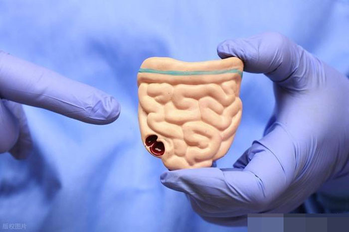 Tưởng rối loạn tiêu hóa ai ngờ là ung thư 5 dấu hiệu trực tràng không nên xem thường