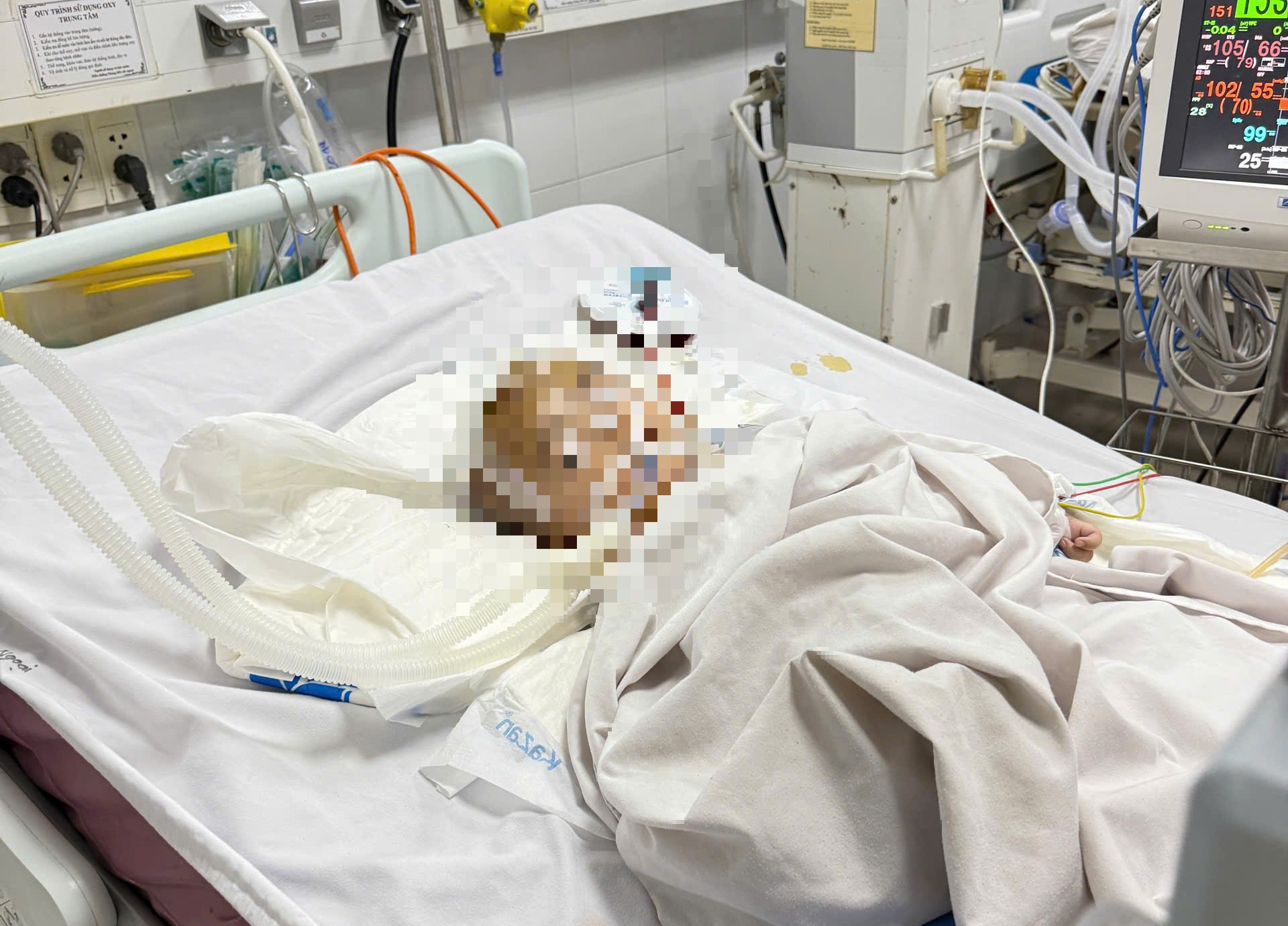 Bé trai xuất huyết não bất thường tại nhóm nhà trẻ tự phát ở Quảng Ngãi - Ảnh 1.