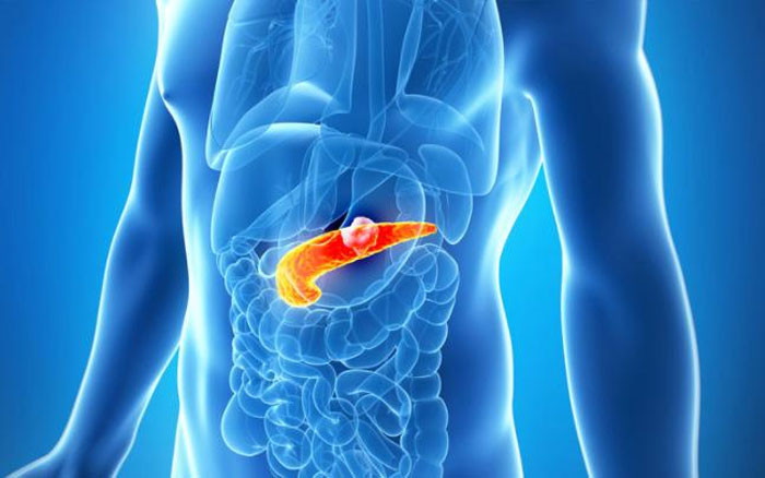 4 dấu hiệu cảnh báo ung thư tuyến tụy nhiều người bỏ qua vì tưởng bình thường