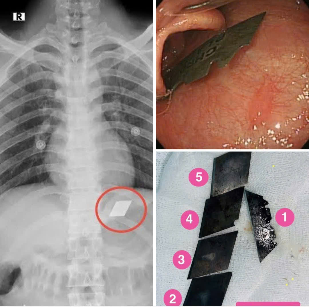 Hãi hùng một bệnh nhân